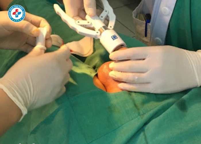 Cắt Bao Quy Đầu Tại Vĩnh Phúc (6)