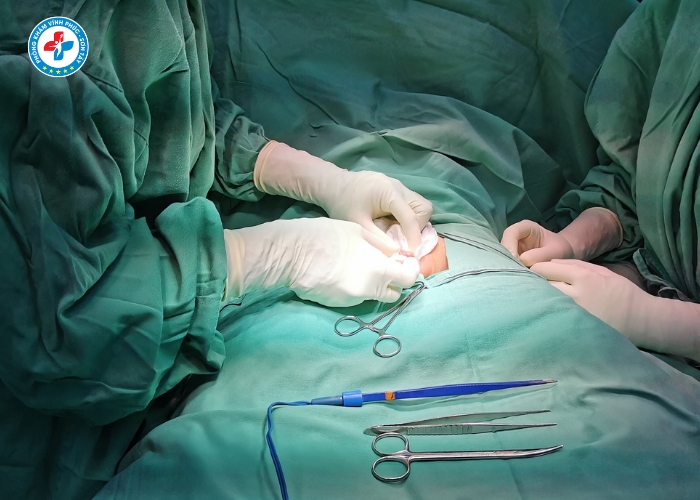 Cắt Bao Quy Đầu Tại Vĩnh Phúc (7)