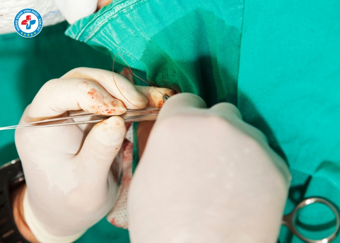 Cắt Bao Quy Đầu Tại Vĩnh Phúc (8)