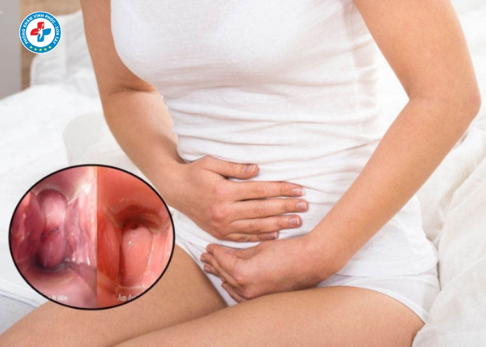 Chữa khí hư bất thường tại Sơn Tây (8)