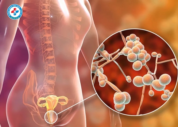 Chữa ngứa vùng kín nữ tại Sơn Tây (9)