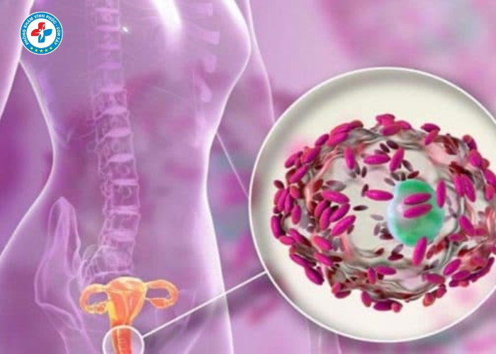 Chữa viêm nhiễm vùng kín tại Vĩnh Phúc (3)