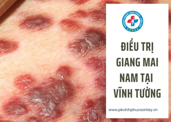 Điều Trị Giang Mai Nam Tại Vĩnh Tường (10)