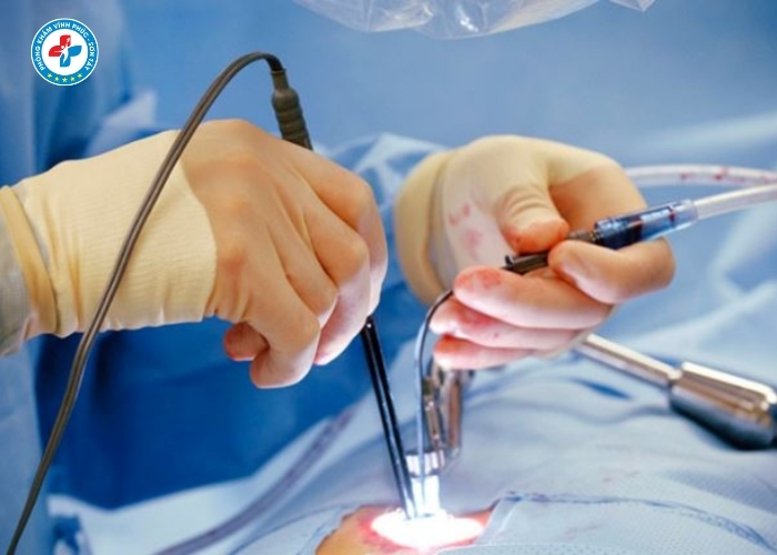 Điều Trị Trĩ Trọn Gói Tại Sơn Tây (6)