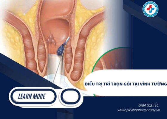 Điều Trị Trĩ Trọn Gói Tại Vĩnh Tường