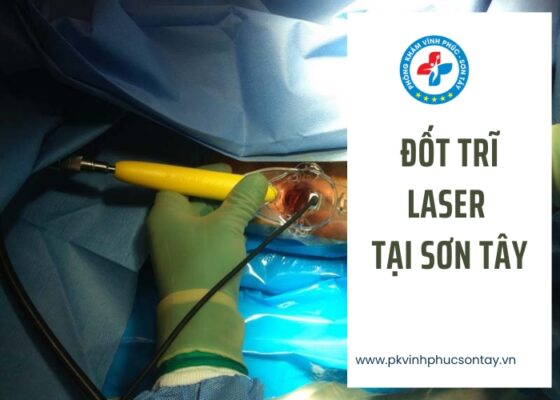 Đốt Trĩ Laser Tại Sơn Tây (4)