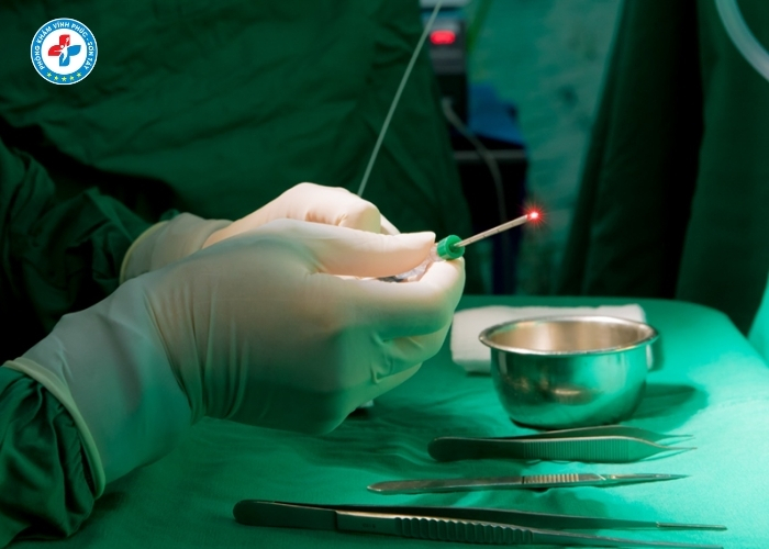 Đốt Trĩ Laser Tại Sơn Tây (7)