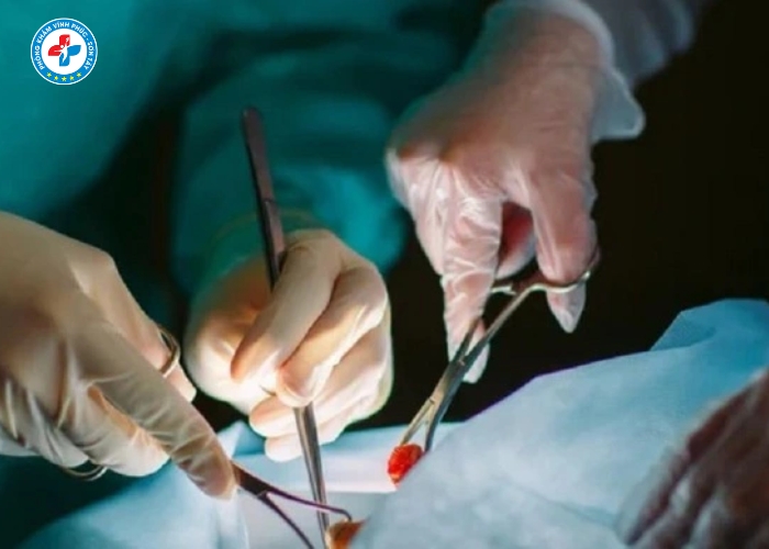 Thắt Ống Dẫn Tinh Tại Vĩnh Tường (11)