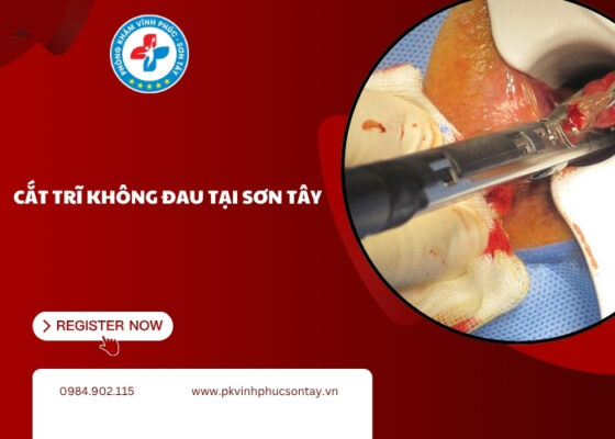 cắt trĩ không đau tại Sơn Tây