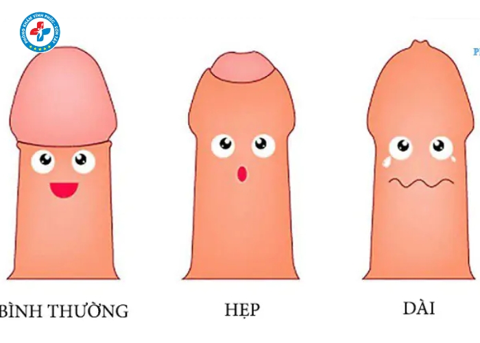 dài bao quy đầu tại Vĩnh Tường (4)