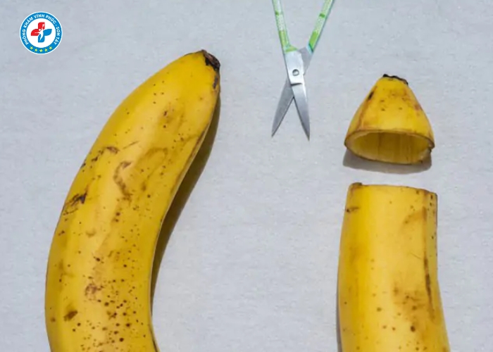 dài bao quy đầu tại Vĩnh Tường (8)