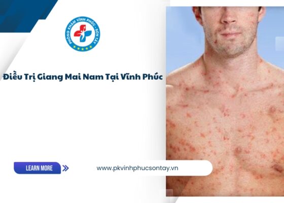 điều trị giang mai nam tại Vĩnh Phúc