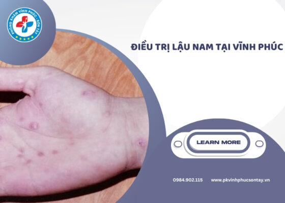 điều trị lậu nam tại Vĩnh Phúc