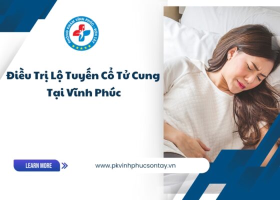 điều trị lộ tuyến cổ tử cung tại Vĩnh Phúc