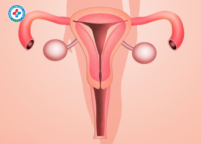 điều trị lộ tuyến cổ tử cung tại Vĩnh Phúc (8)