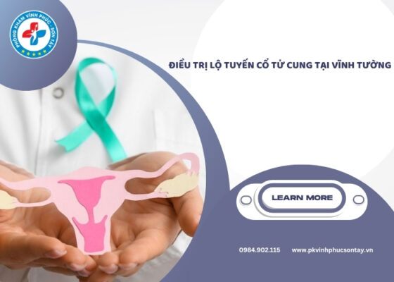 điều trị lộ tuyến cổ tử cung tại Vĩnh Tường