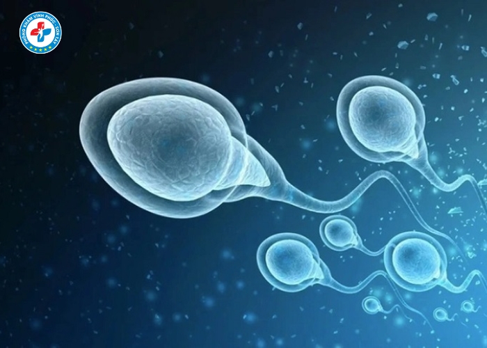 điều trị tinh trùng yếu tại Vĩnh Phúc (10)