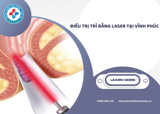 điều trị trĩ bằng laser tại Vĩnh Phúc (2)