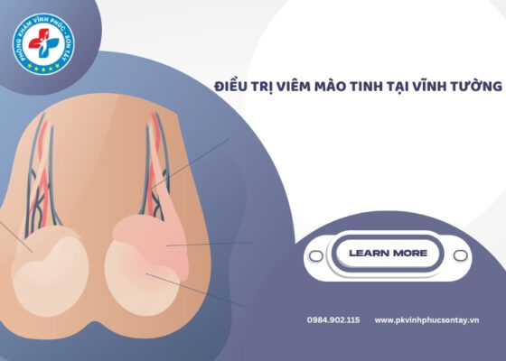 điều trị viêm mào tinh tại Vĩnh Tường