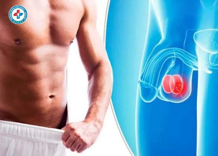 điều trị viêm mào tinh tại Vĩnh Tường (8)