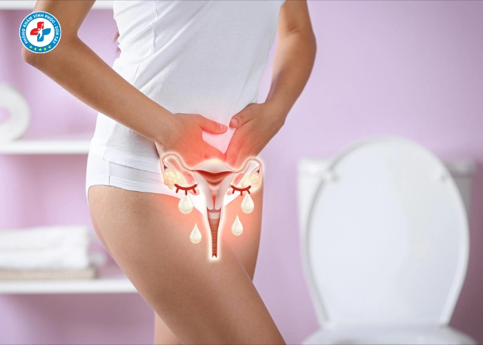 điều trị viêm phụ khoa tại Vĩnh Tường (10)