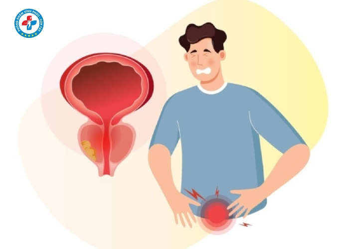 điều trị viêm tuyến tiền liệt tại Vĩnh Tường (5)