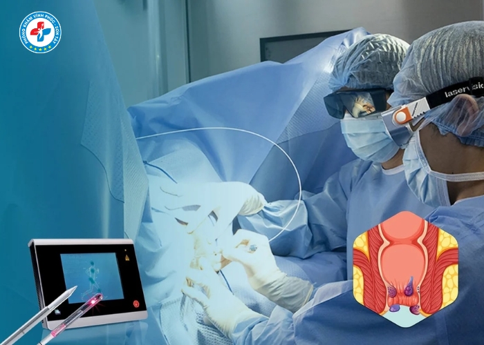 đốt trĩ laser tại Vĩnh Tường (4)