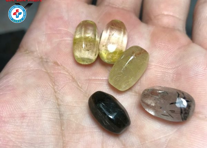 găm bi dương vật tại Vĩnh Tường (6)