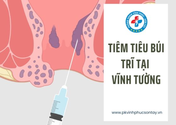 tiêm tiêu búi trĩ tại Vĩnh Tường (1)