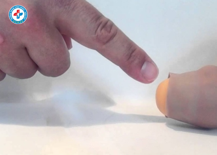 Dài bao quy đầu tại Sơn Tây (3)