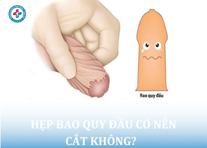 Hẹp bao quy đầu tại Sơn Tây (10)