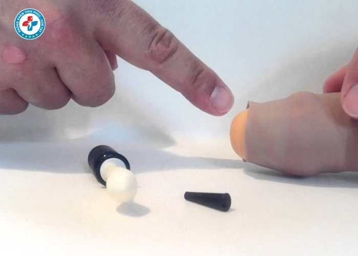 Hẹp bao quy đầu tại Sơn Tây (7)