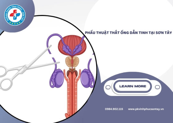 Phẩu thuật thắt ống dẫn tinh tại Sơn Tây (2)