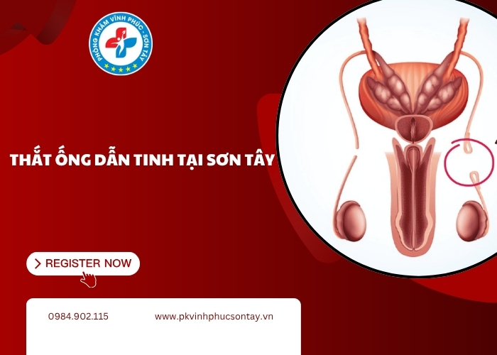 Thắt ống dẫn tinh tại Sơn Tây (8)