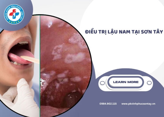 điều trị lậu nam tại Sơn Tây