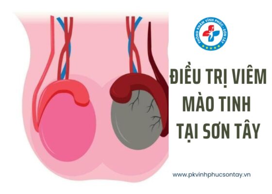 điều trị viêm mào tinh tại Sơn Tây (8)