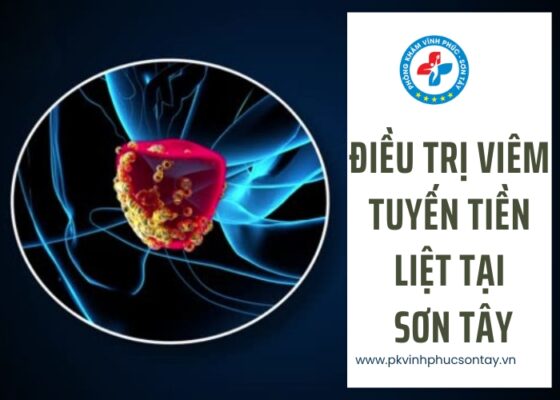 điều trị viêm tuyến tiền liệt tại Sơn Tây