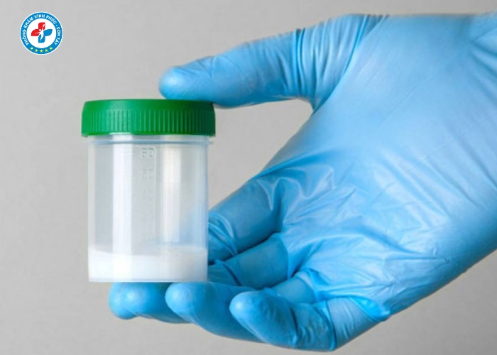 điều trị vô sinh nam tại Sơn Tây (22)