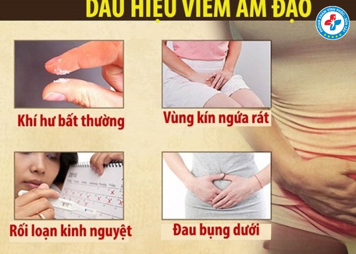 Dấu hiệu bị viêm nhiễm phụ khoa nặng (7) Dấu hiệu bị viêm nhiễm phụ khoa nặng (7)