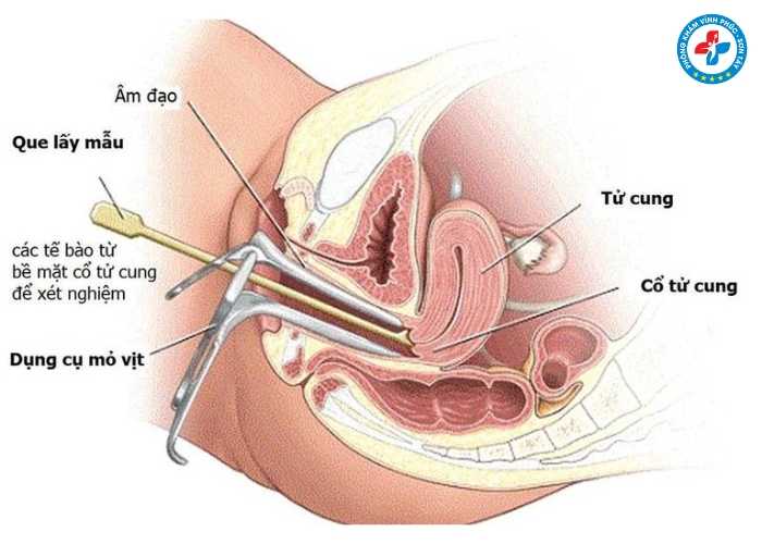 khám phụ khoa có đau không (2)