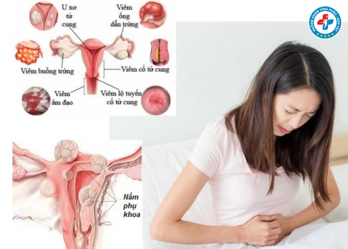 khám phụ khoa có đau không (7)