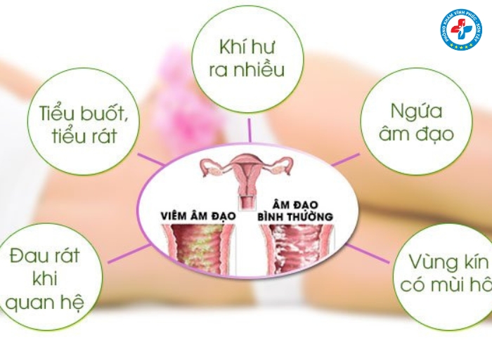 Cách làm sạch vùng kín đúng cách để tránh viêm nhiễm Cách làm sạch vùng kín đúng cách để tránh viêm nhiễm