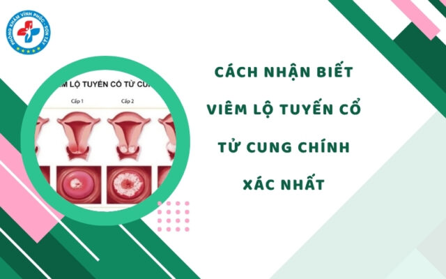 Cách nhận biết viêm lộ tuyến cổ tử cung