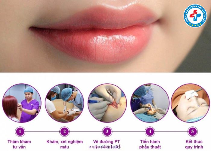 Cắt môi trái tim tại Vĩnh Phúc (4)
