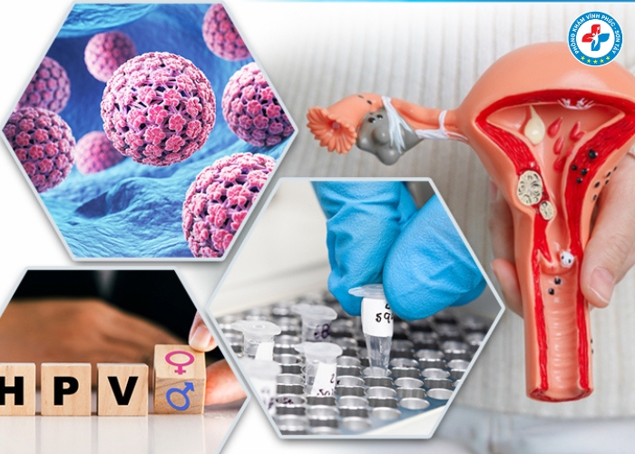 Chi phí xét nghiệm HPV và tầm soát ung thư (3) Chi phí xét nghiệm HPV và tầm soát ung thư (3)