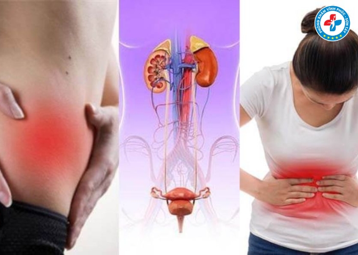 Đau bụng dưới sau khi quan hệ có nguy hiểm không (4) Đau bụng dưới sau khi quan hệ có nguy hiểm không (4)