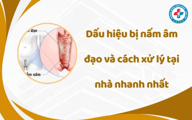 Dấu hiệu bị nấm âm đạo và cách xử lý tại nhà