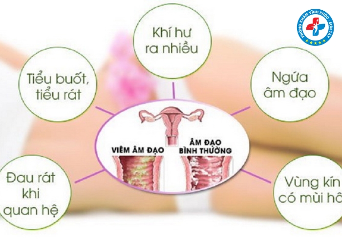 Dấu hiệu viêm nhiễm phụ khoa giai đoạn đầu