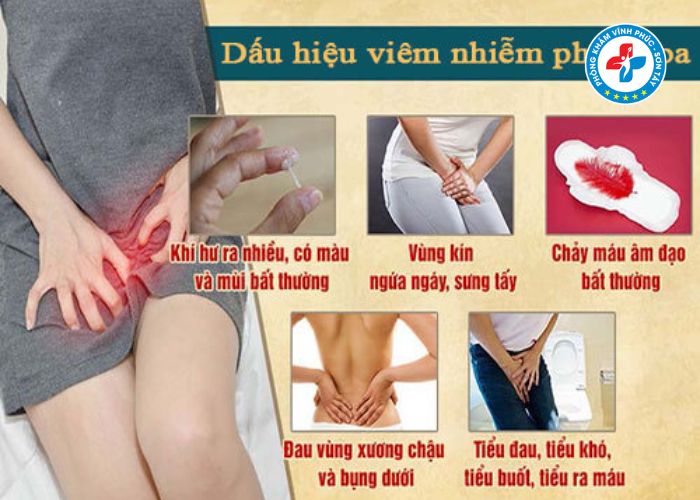 Dấu hiệu viêm nhiễm phụ khoa nhẹ (6) Dấu hiệu viêm nhiễm phụ khoa nhẹ (6)