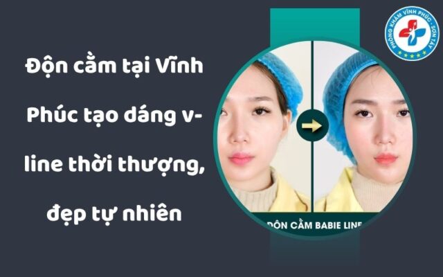 Độn cằm tại Vĩnh Phúc